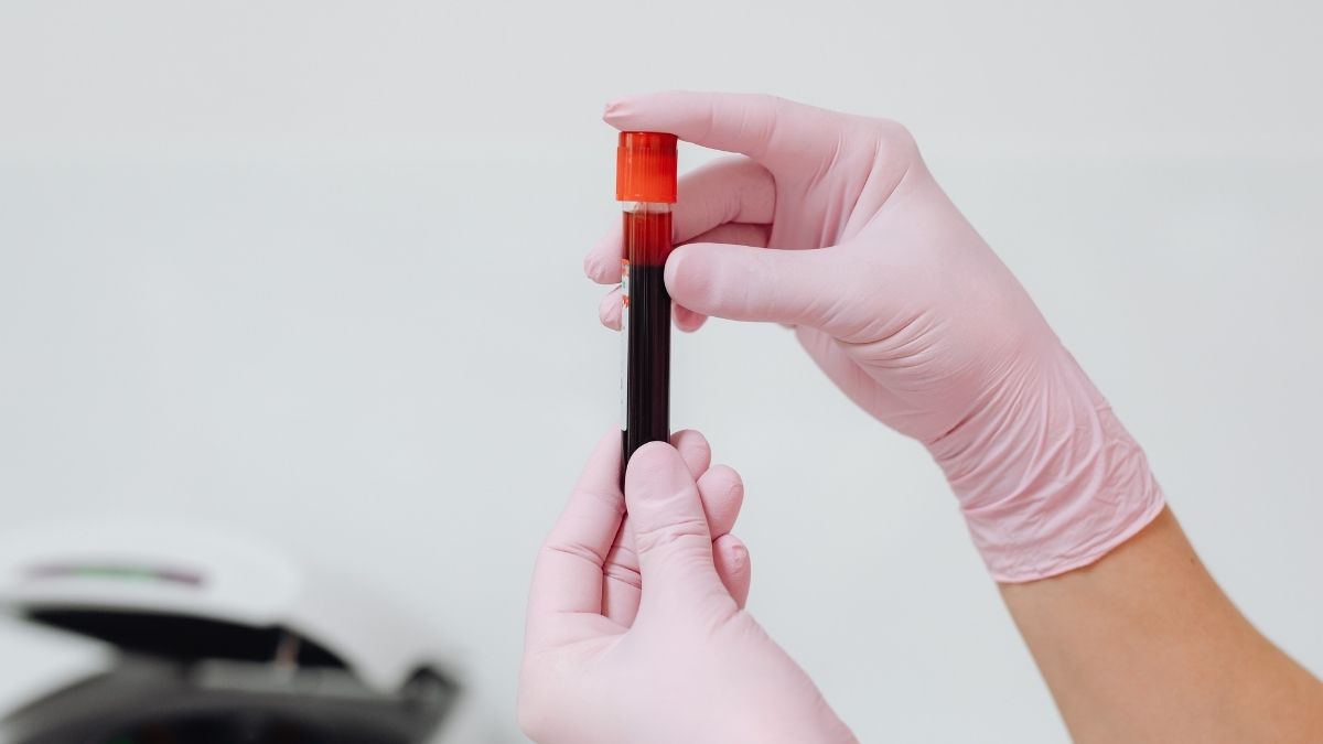 How Does the CBC and CMP-14 Blood Test Panel Give a Complete Health Snapshot?